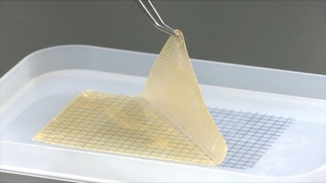 技術よ 小さき命を救え 〜町工場 夢の心臓・血管パッチ開発〜