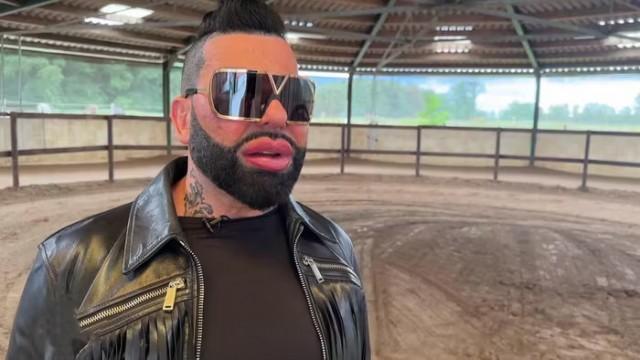 Herr Glööckler im Catwalk-Stress