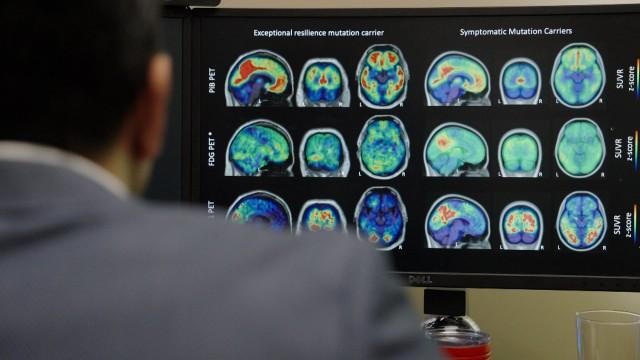 認知症 克服のカギ