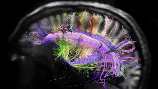 Lo mejor de ‘Hoy en EL PAÍS’ | Tu cerebro es oro: ¿qué harás con él cuando mueras?