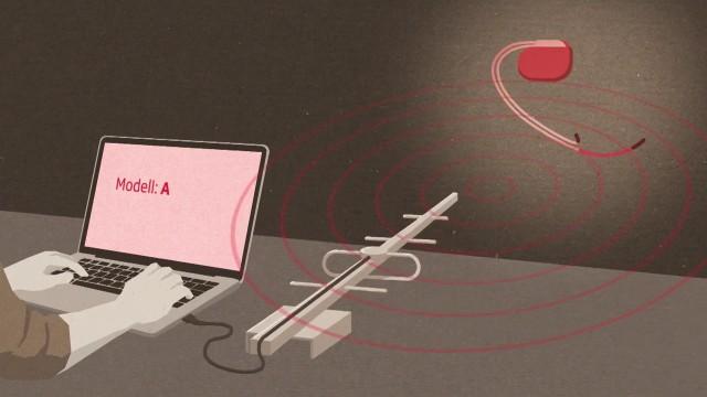Extra zu "Kammerflimmern": Herzimplantate – Ein Ziel für Hacker?