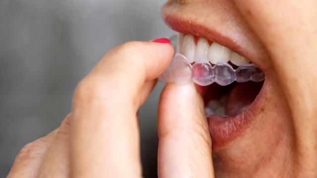 Por salud o por estética: ¿tú también llevas ortodoncia invisible?