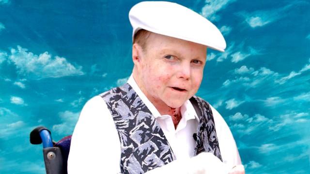 The Boy Whose Skin Fell Off