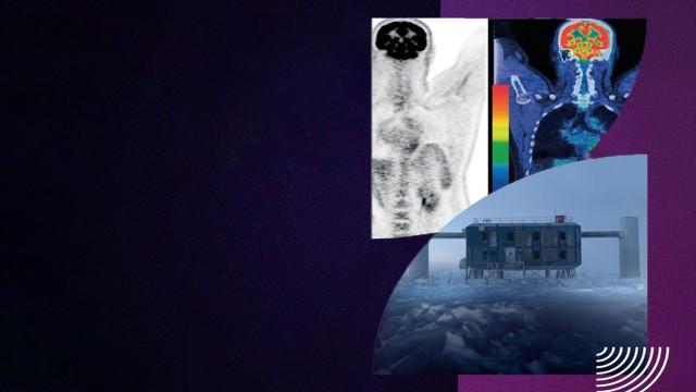 Fisinews #008 - Raios cósmicos, ondas de rádio e novidades em imagens médicas