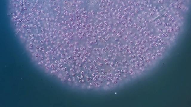 The Purple Bacteria That Are Afraid of Oxygen