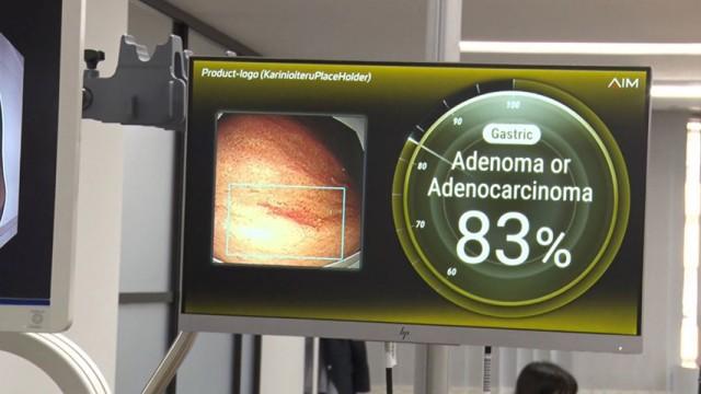 がんを早期発見！ 命を救うニッポンの技術