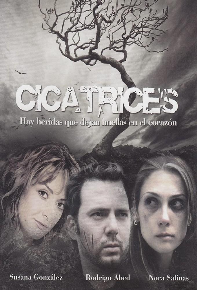 Scars
