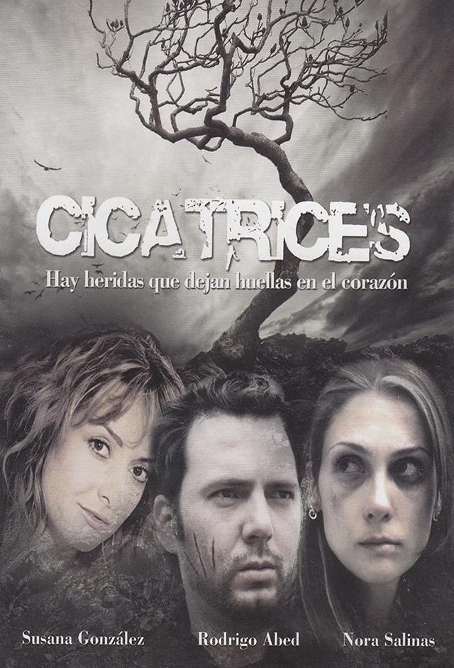 Scars