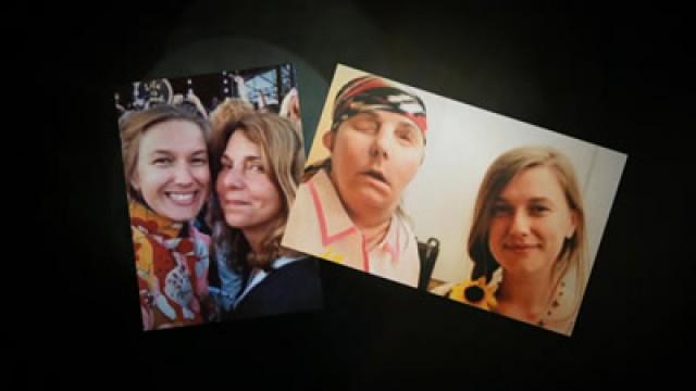 Face Transplants/Condors