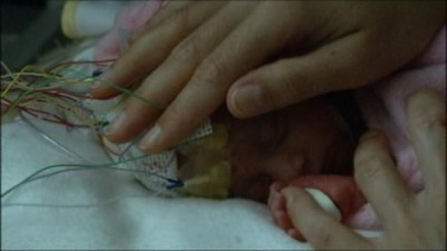 The Baby's Brain: Wider Than The Sky