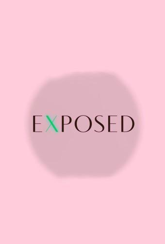 eXposed