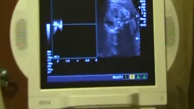 Ultrasound at 27 Weeks Pregnant!