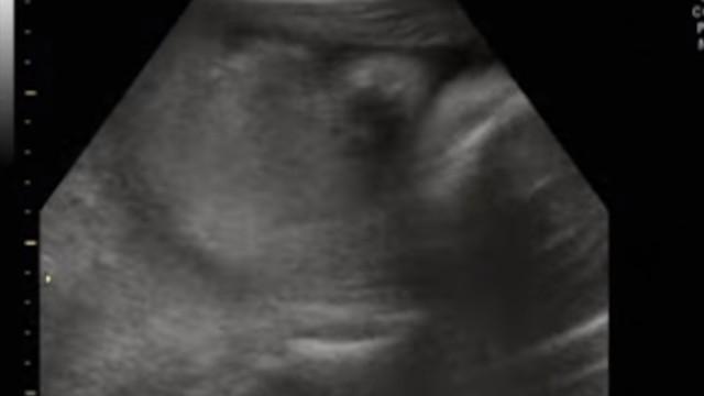 3D/4D Ultrasound at 29 Weeks Pregnant! (Part 1)