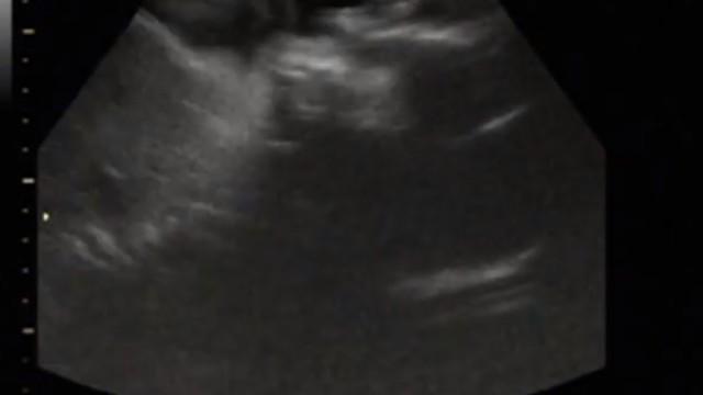 3D/4D Ultrasound at 29 Weeks Pregnant! (Part 2)