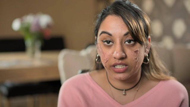 Baby You Can Hide My Scar