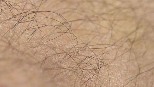 Nos poils repoussent-ils en plus grand nombre lorsqu’on les rase ?