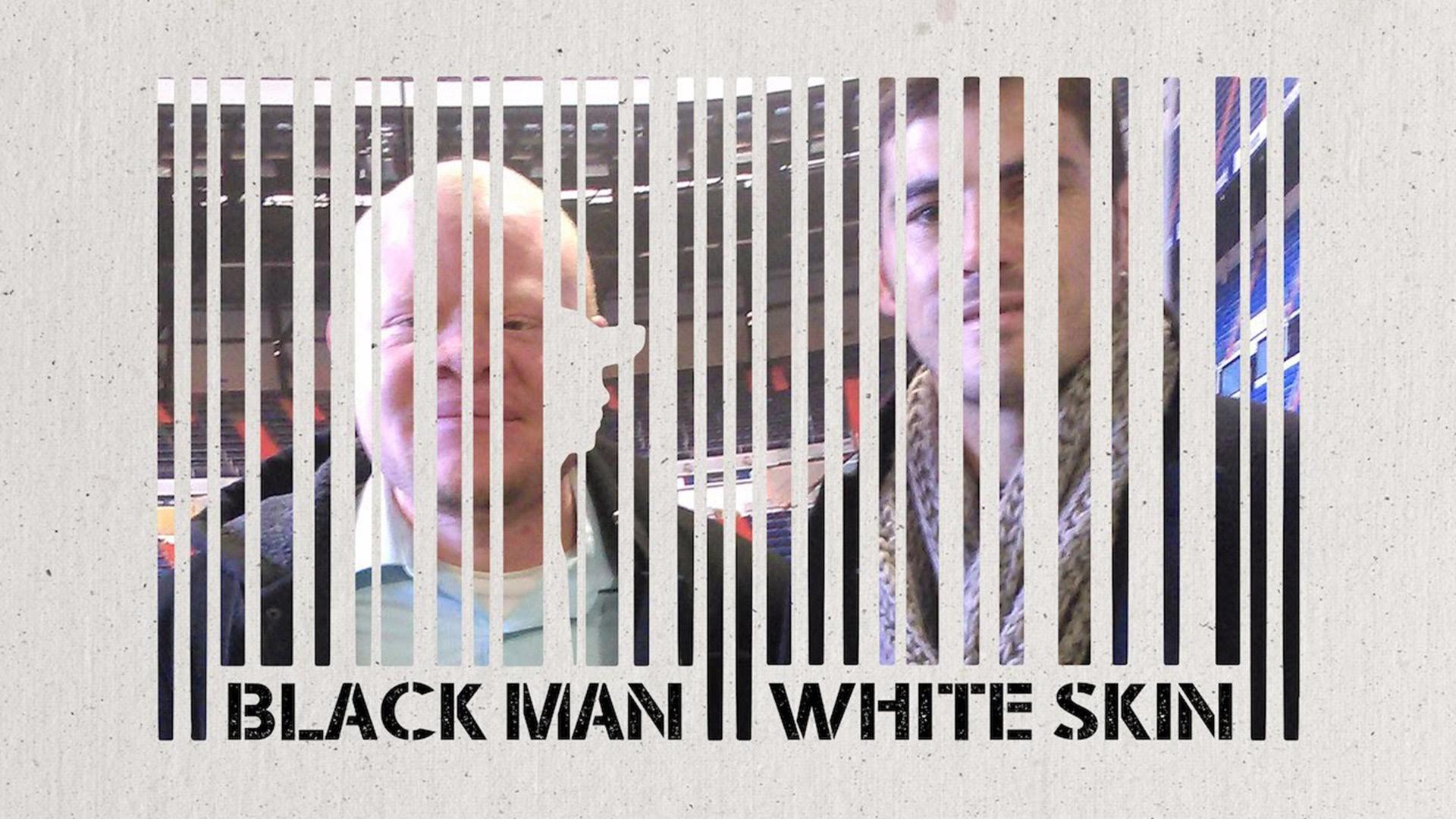 Black Man White Skin